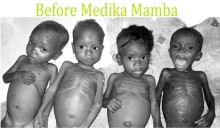 before medika mamba